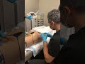 Monster Zombie BBL 20 Vials Of Sculptra 12 Syringes Of PRP Making This The Ultimate Bubble Butt