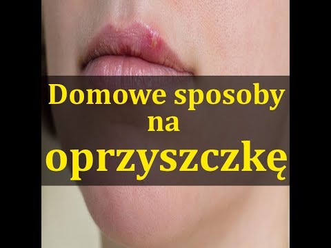 Agrest indyjski olej na włosy, aby kupić Szampon łysiejący mężczyźni