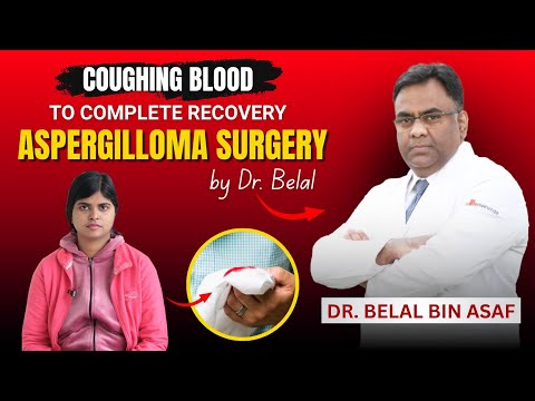 From Coughing Blood to Life Saved — How Dr. Belal Removed a Diseased Lung Part 🫁