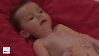 Learn to Spot the Warning Signs of SMA – Floppy Baby (Video 5)