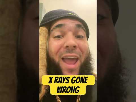 X RAYS GONE WRONG 😑 #cheekofue #comedy #newrapper #funny #xray #hospital #grady LEAVE A COMMENT