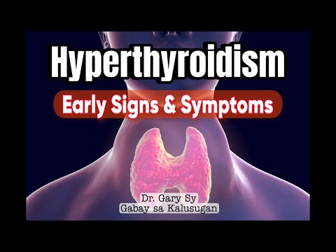 Hyperthyroidism (Overactive Thyroid) - Dr. Gary Sy
