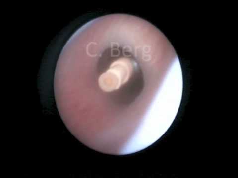 Gesundheit Behandlung Joint Bedeutet Salze Gelenke zurückzuziehen