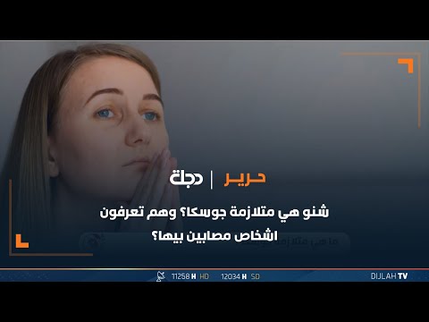 شاهد بالفيديو.. شنو هي متلازمة جوسكا؟ وهم تعرفون اشخاص مصابين بيها؟
