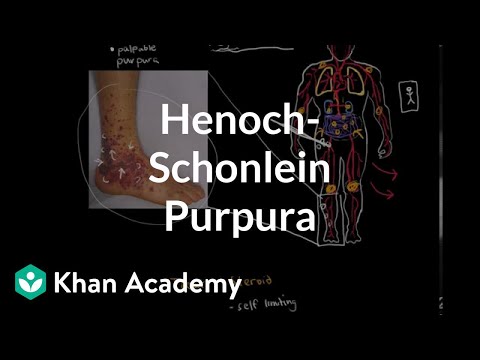 Henoch-Schonlein purpura | Circulatory System and Disease | NCLEX-RN | Khan Academy