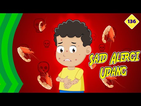 181 Kompilasi 3 Video ❤ Said Alergi - Jamal Laeli Series Official