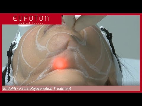 Se è necessario asciugare dopo una maschera una faccia con tonico La maschera da appassire di pelle di faccia