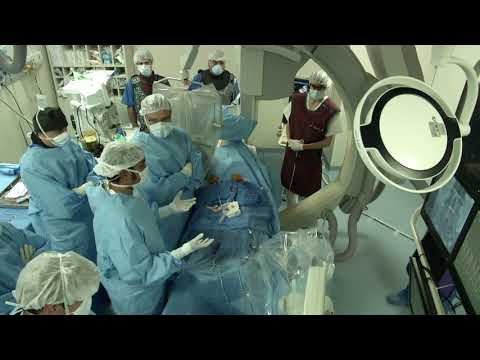 TAVR Cusp Overlapping Technique