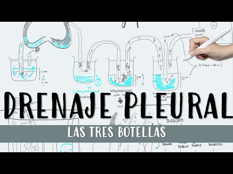 THE THREE BOTTLES OF PLEURAL DRAINAGE #surgery #thorax #effusion #pneumothorax #pleural #pleura