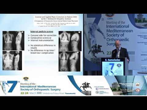 E Samoladas - Screw density in spine deformity correction