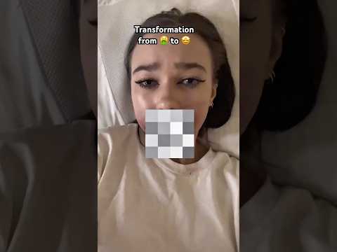 From ugly 🤮 to pretty 🤩 - BEFORE OR AFTER?