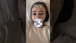 Download lagu From ugly 🤮 to pretty 🤩 - BEFORE OR AFTER? mp3