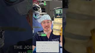Reversing a spinal fusion with a disc replacement? ud83euddd0