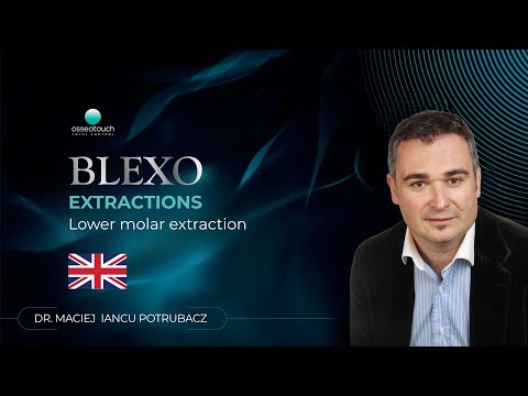 BLEXO clinical case — lower molar extraction
