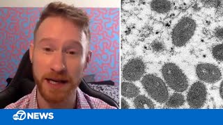 Man recovering from monkeypox describes experience