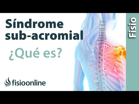 ¿Qué es el síndrome subacromial o síndrome de impactación?