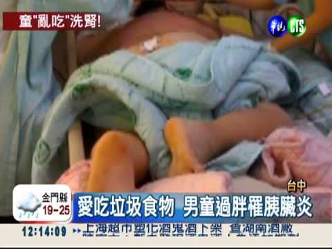 男童暴飲暴食 體重破百罹胰臟炎