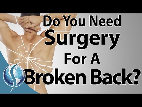 Do You Need Surgery For A Broken Back?
