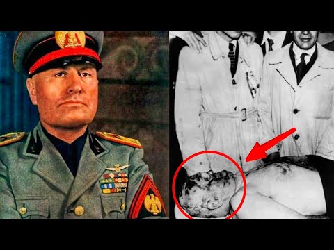 Mussolini’s Hidden Brain Illness: Doctors Kept Secret for 50 Years