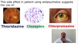 Psychiatry Quick Review (2)   #cme #internal_medicine #usmle #محاضرات_باطنة #medicine