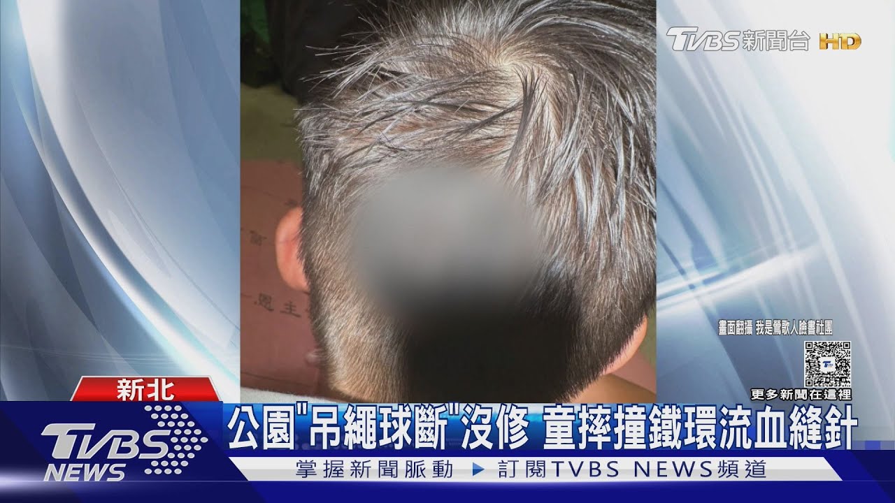 吊繩球遊具成傷童陷阱!繩索斷裂害男童摔落地 頭撞鐵環流血