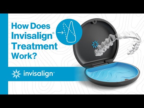 How Does Invisalign® Treatment Work?