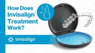 Invisalign How does Invisalign® treatment work?