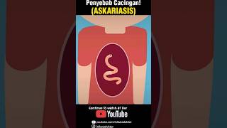 Download lagu Penyebab Cacingan #kesehatan #edukasi #animasi mp3