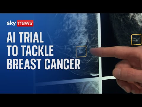 Major breast cancer screening AI trial launched