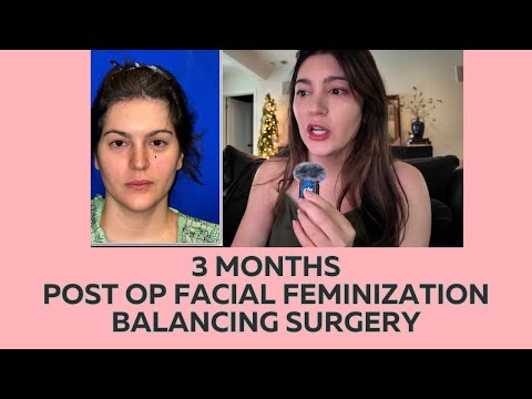 3 Months Post Op | FFS | Facial Balancing Surgery with Before Photos