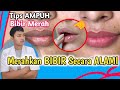 Quick Ways To Naturally Redden Lips Effective Tips To Brighten Dark Lips Dr Andi Septiawan