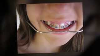 preview picture of video 'Urgent|Orthodontics|423-396-4222|Collegedale|Tennessee|37315|Orthodontist|TN'