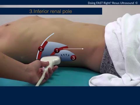 5 minute How to do FAST ultrasound like expert