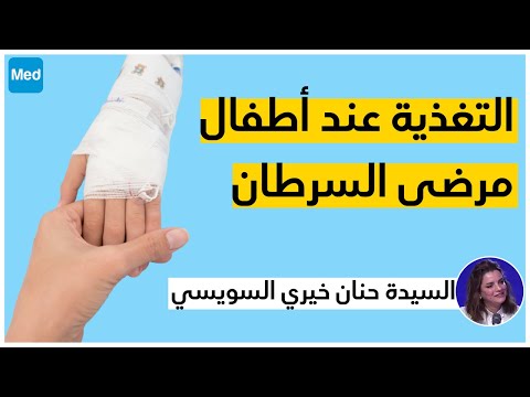 التغذية عند أطفال مرضى السرطان