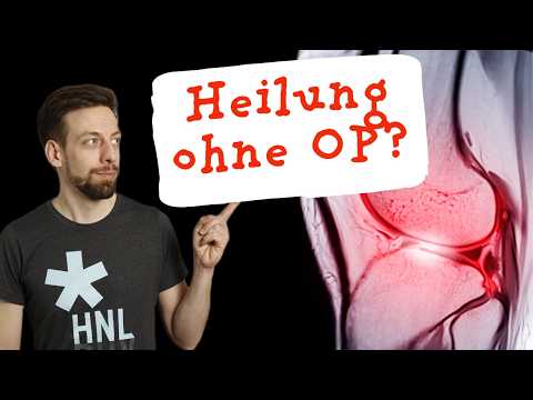 Kreuzband-Wunder OHNE OP?! Die Studie zum Cross Bracing Protocol