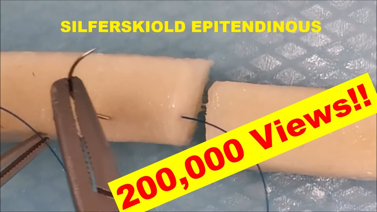 Flexor Tendon Repair Techniques