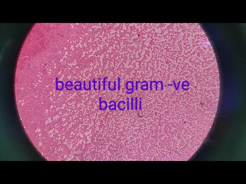 gram negative bacilli looking absolutely stunning!