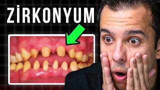 ZİRKONYUM DİŞ...En Çok Sorulan 4 Soru (VE GERÇEK CEVAPLAR !)