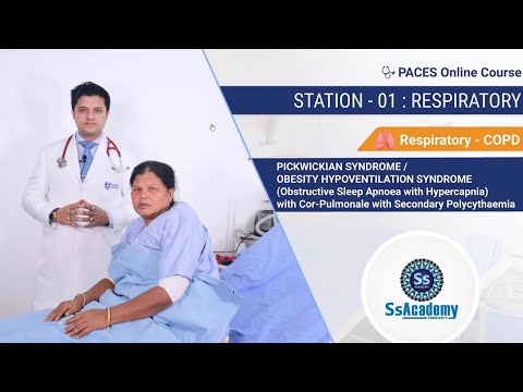 PACES 2023 New Format | Pickwickian Syndrome | Obstructive sleep Apnoea with Hypercapnia with CP