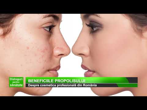 Dialoguri pentru sanatate la Medika TV - Tratamentele apiestetice