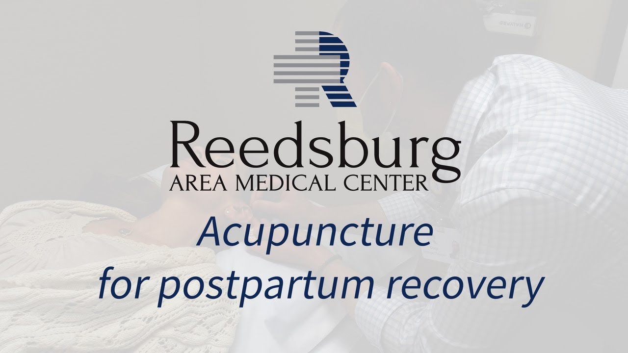 Acupuncture for Postpartum Recovery