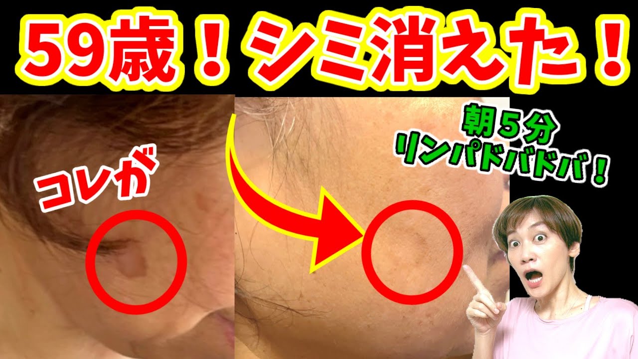 整形級！顔のシミ消えた！朝５分でリンパドバドバ❕若返る♪