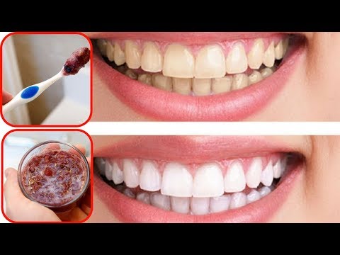 3 Natural Ways to Whiten Teeth at Home | Natural Life