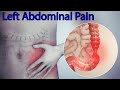 Upper Left Stomach Pain, Upper Left Abdominal Pain, upper left quadrant pain