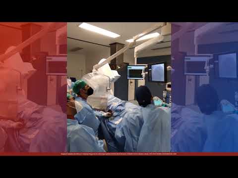 Angioplastia - Equipo Médico "Deja tu salud en manos del experto"