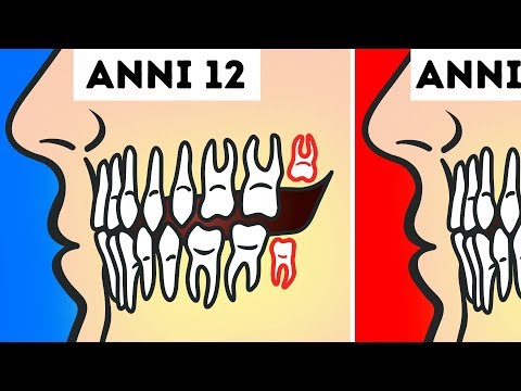 È misurato i posti di pigmentary Cosmetici a pigmentazione di pelle