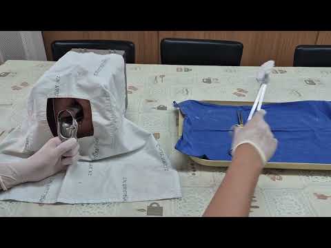 Manual vacuum aspiration MVA procedure