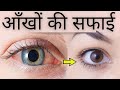 How To Get Clear And Brighten Eyes - आँखों की सफाई  | Eyes Whitening Tips