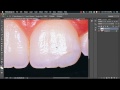 photoshop tutorial fixing chipped missing and discolored teeth easily