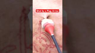 This Arrow Got STUCK in My Leg… #shorts #funny #science